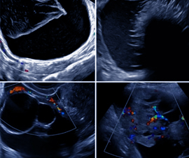 scehduled-event-cover