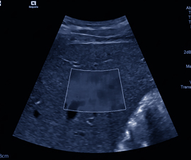 scehduled-event-cover