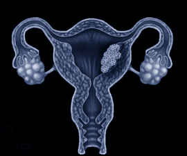 scehduled-event-cover