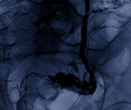 scehduled-event-cover